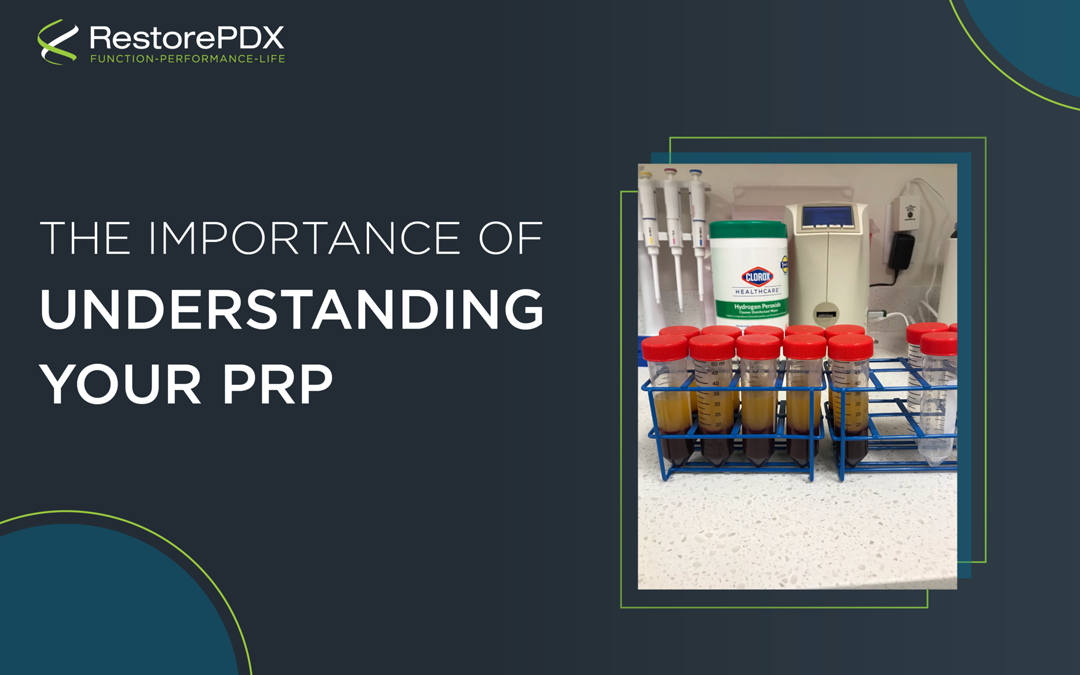 Buyer Beware, Not All Platelet Rich Plasma (PRP) Is Created Equal